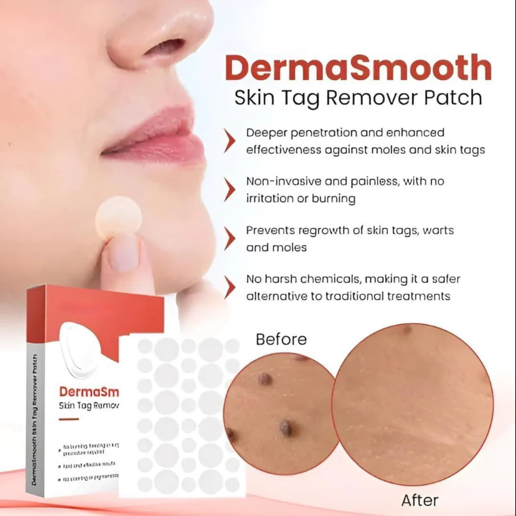 DermaSmooth Skin Tag Remover Patch