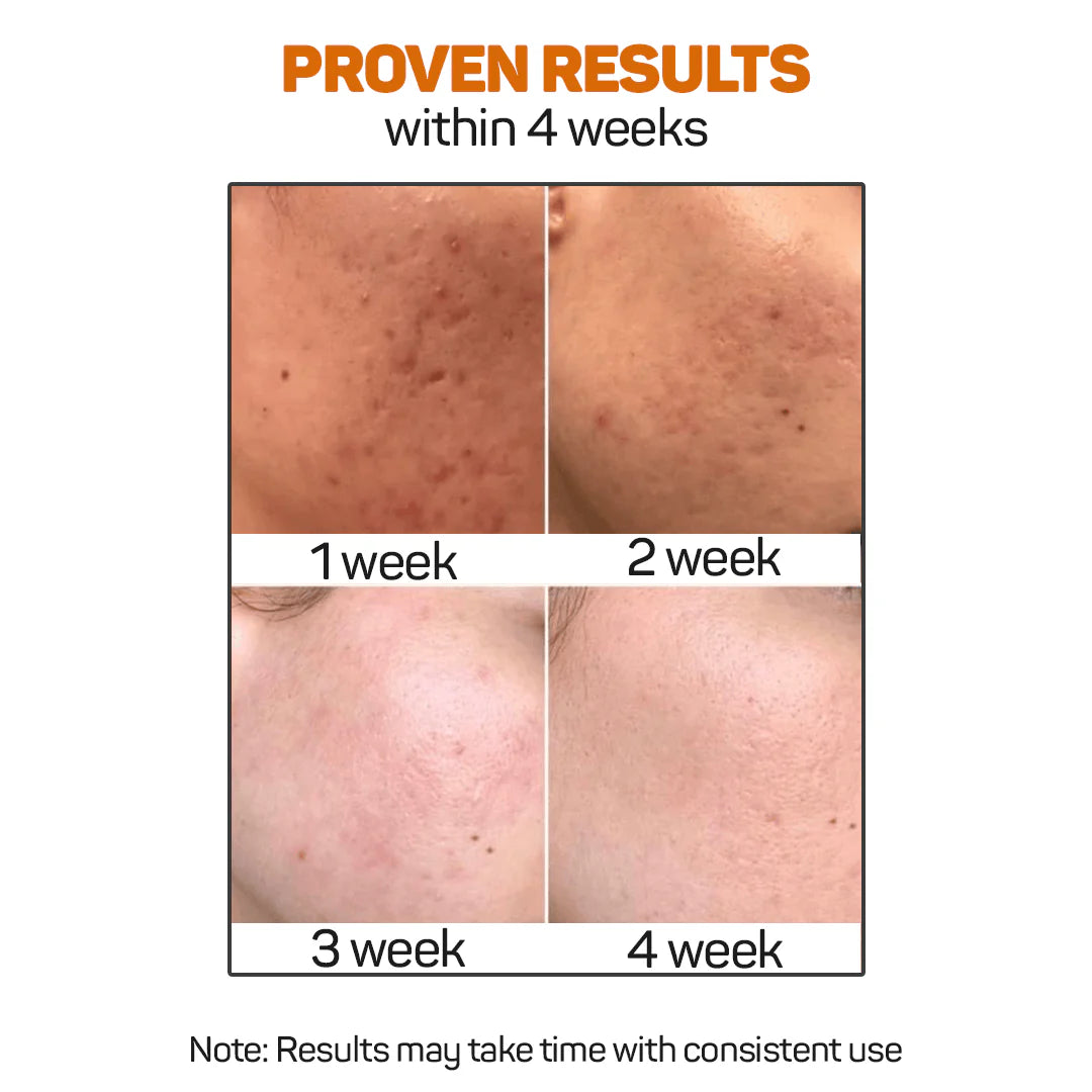 Vitamin C Serum